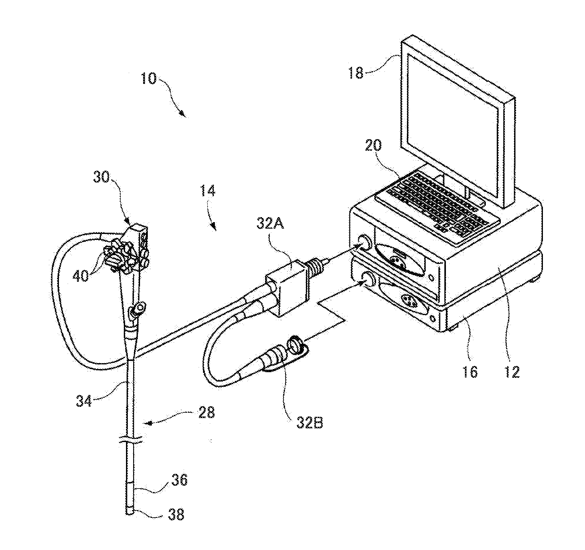 Endoscopic diagnosis system