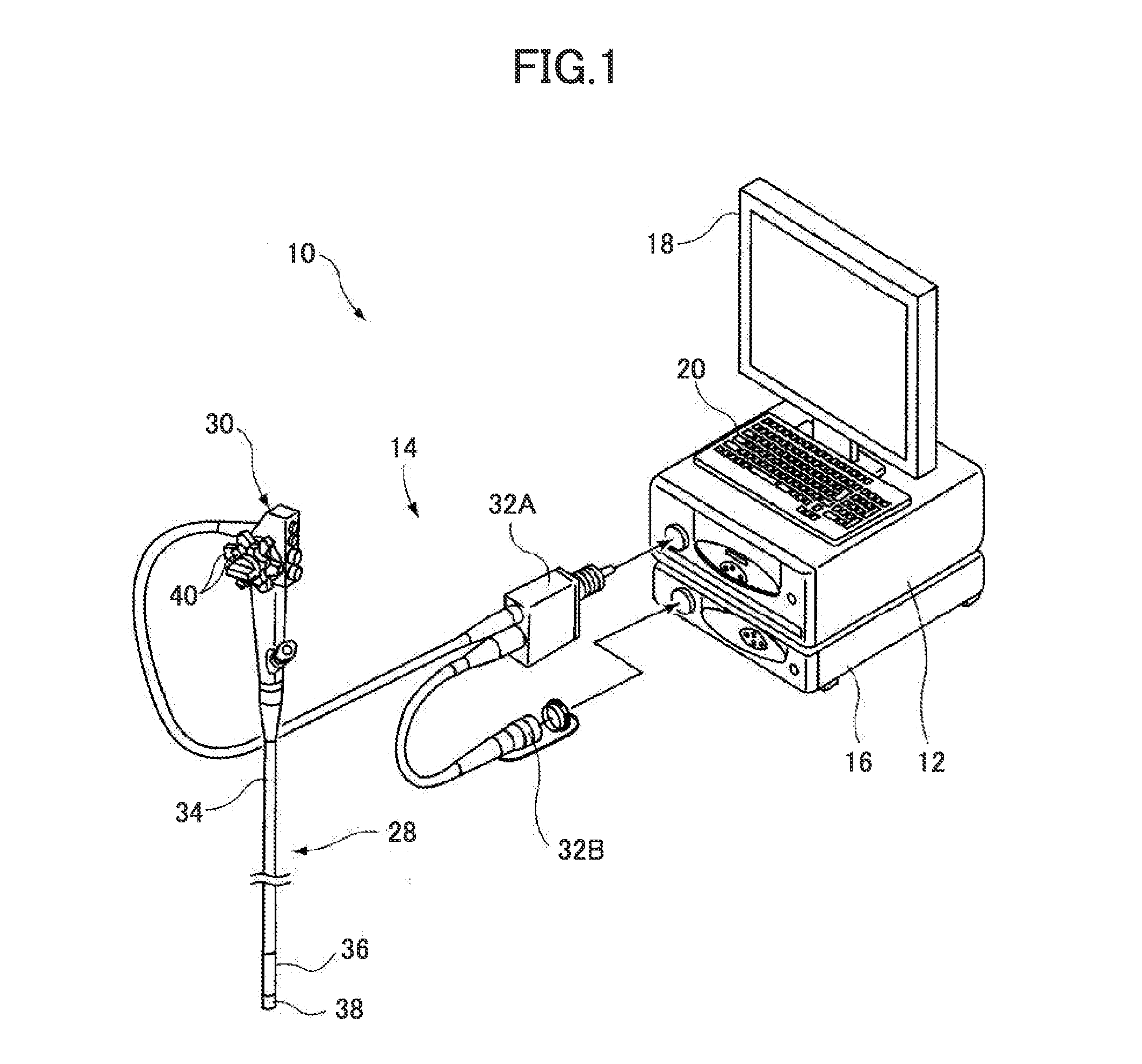 Endoscopic diagnosis system