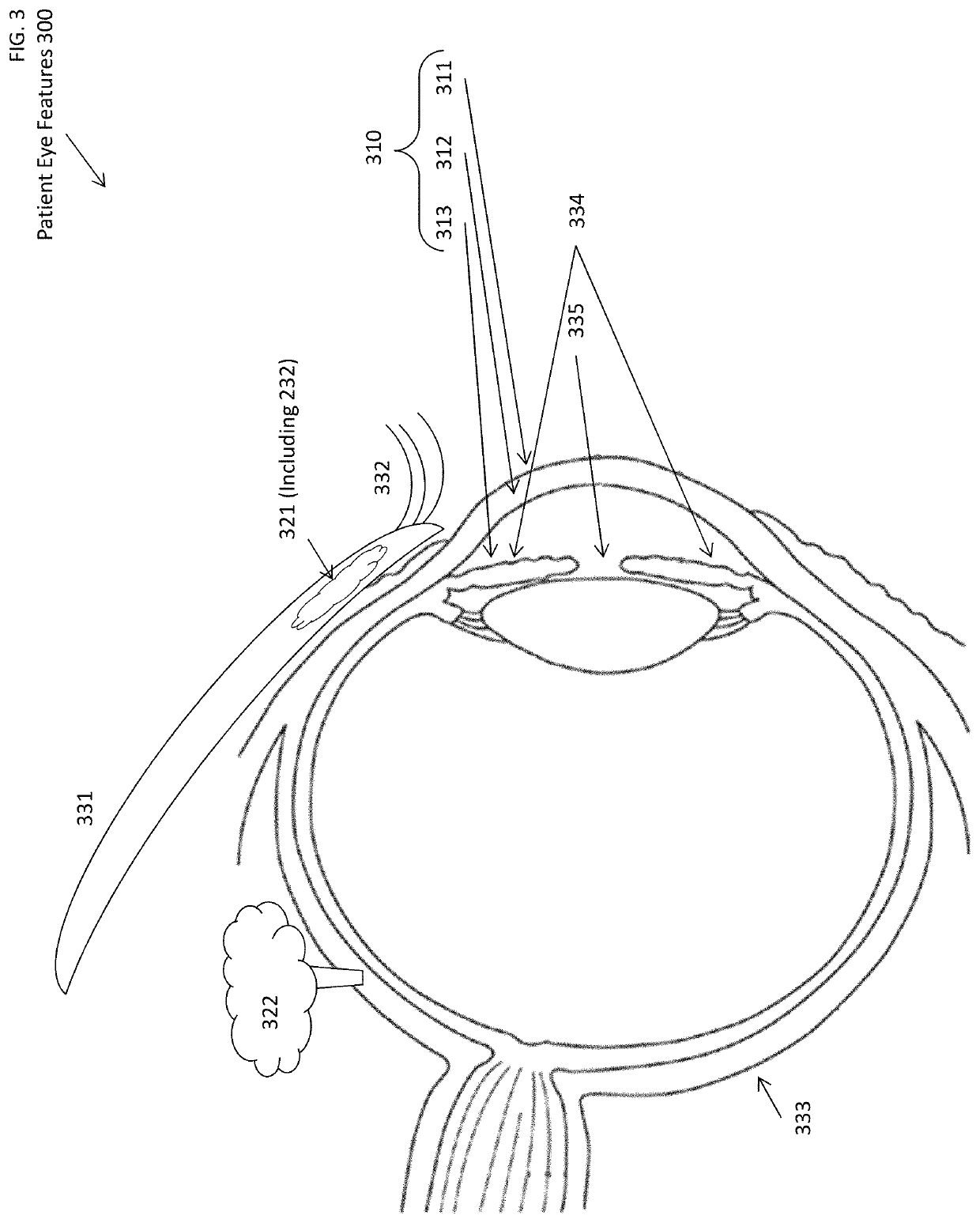 Digital eyewear procedures related to dry eyes