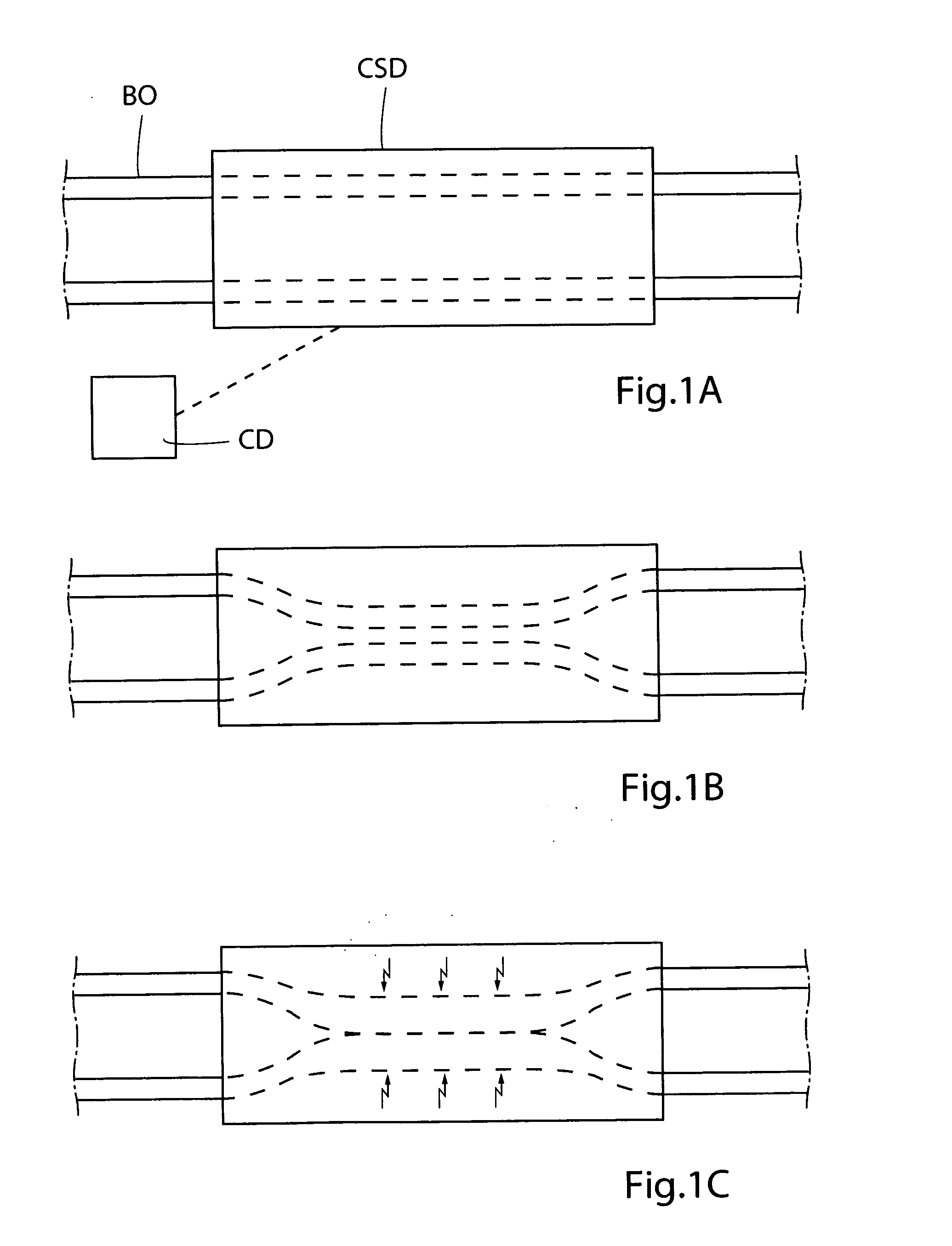 Method for controlling flow in a bodily organ