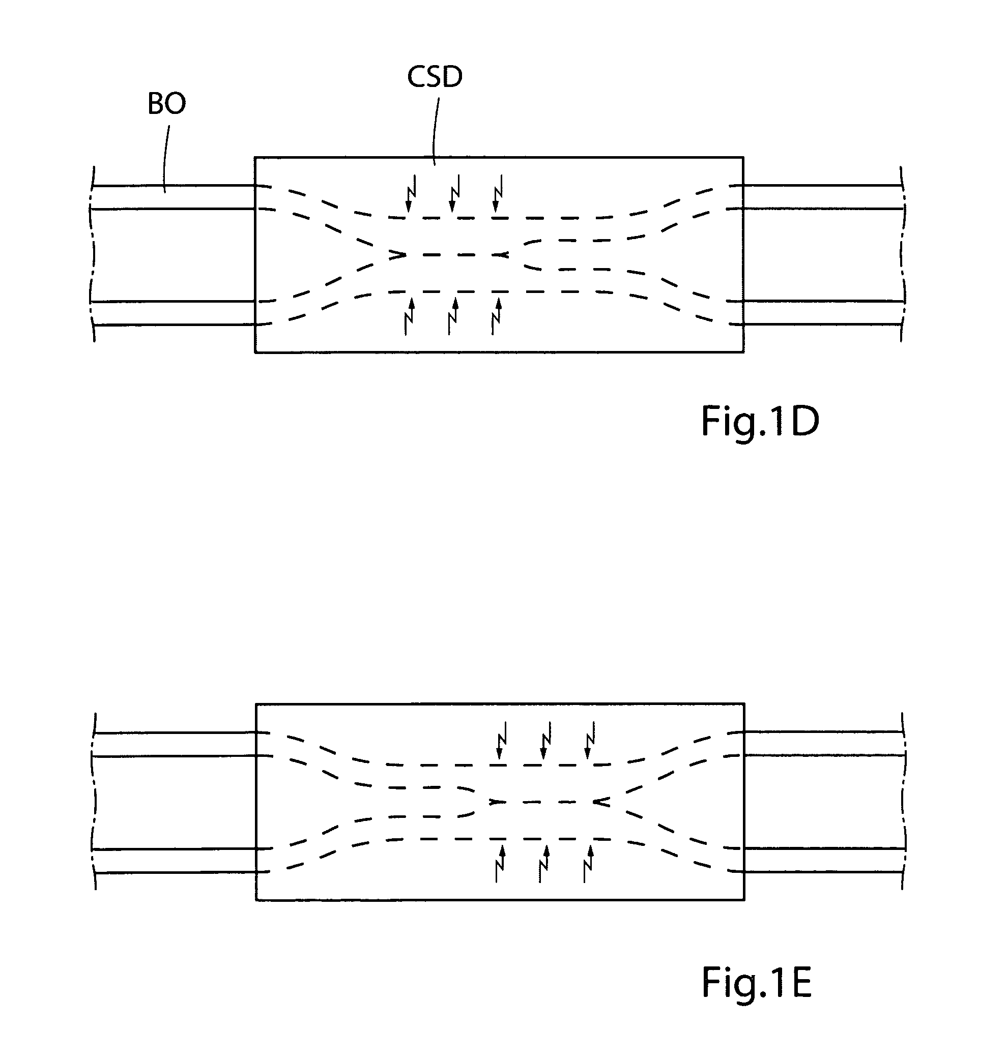 Method for controlling flow in a bodily organ