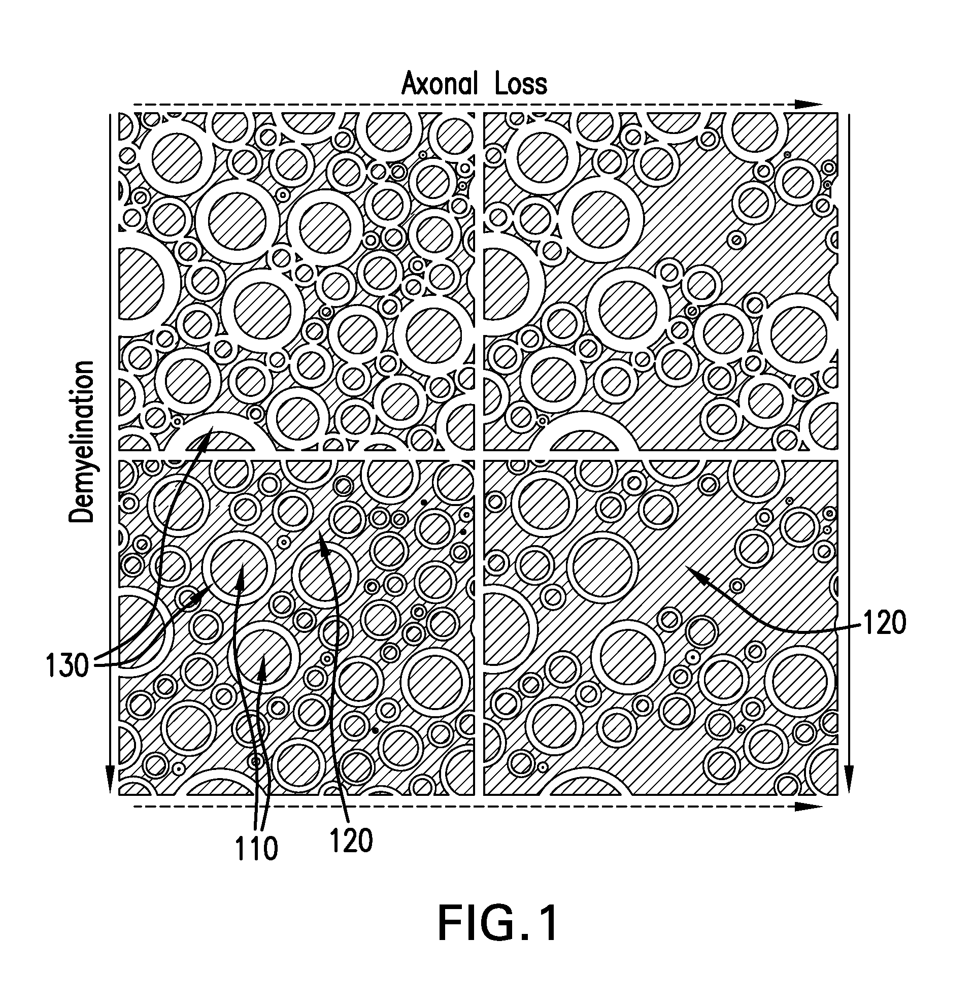 System, method and computer accessible mediums or determining neurodegeneration