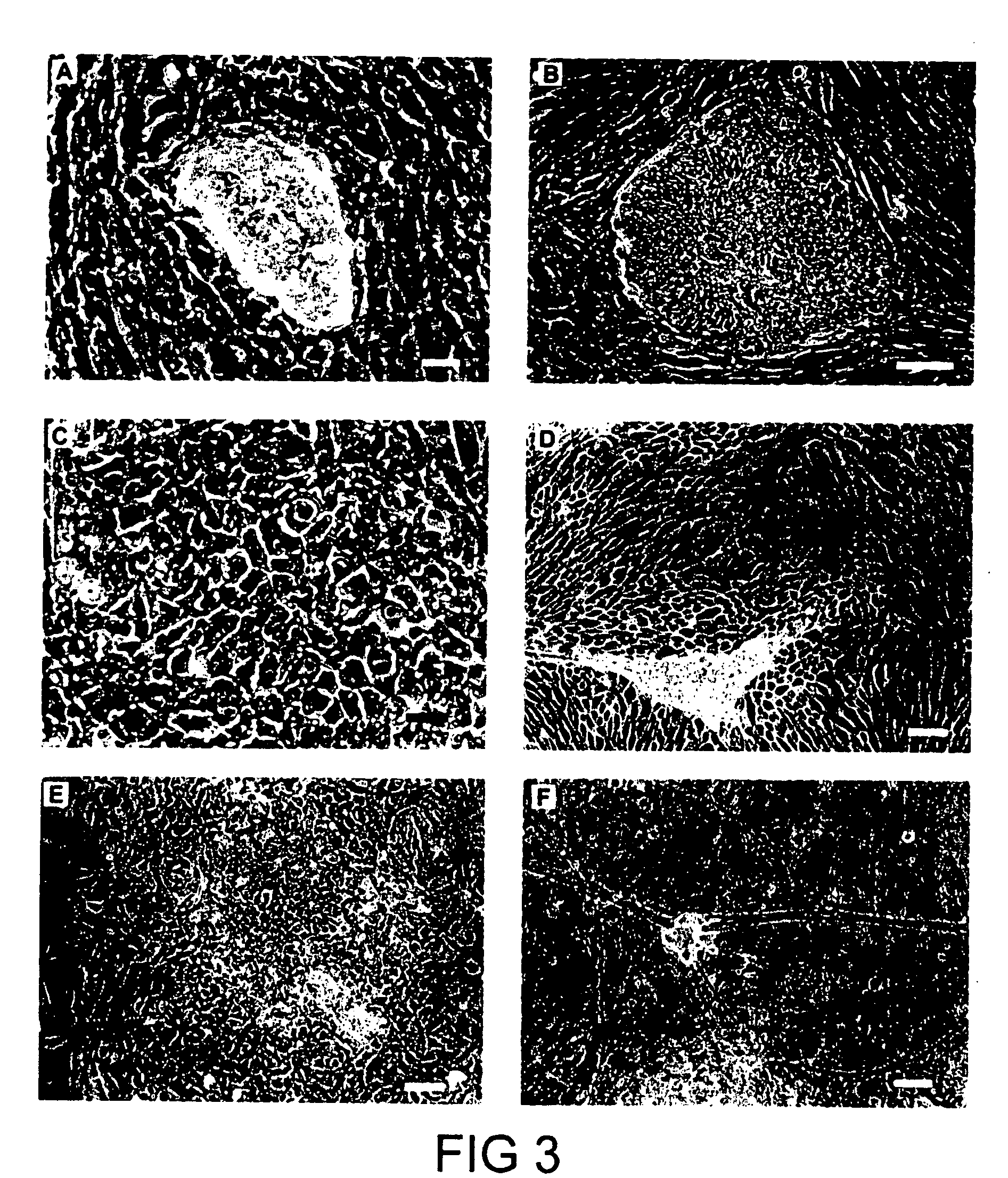 Embryonic stem cells