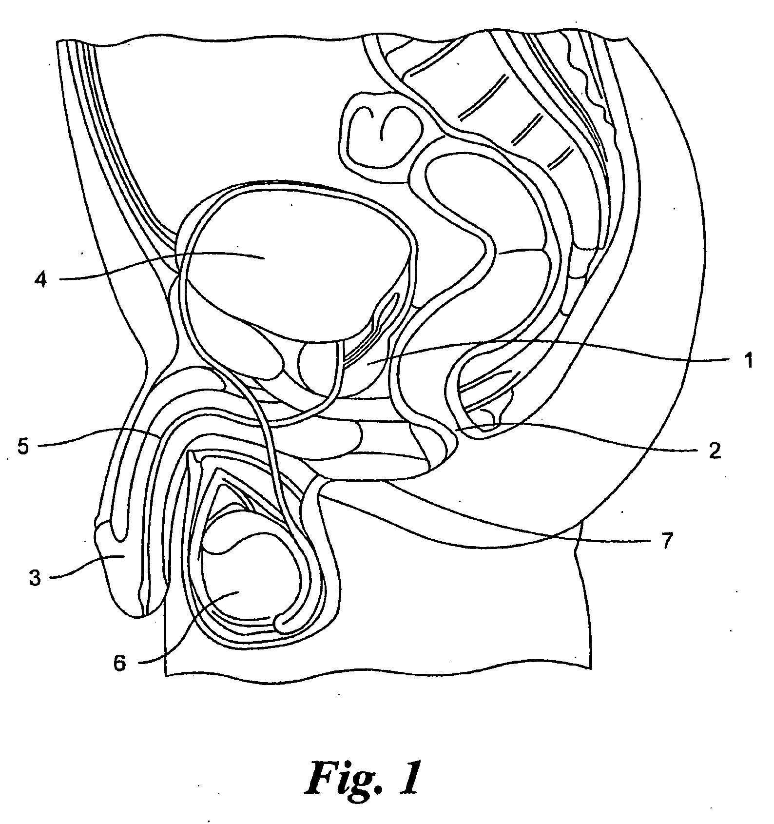 Therapeutic device for thermally assisted urinary function