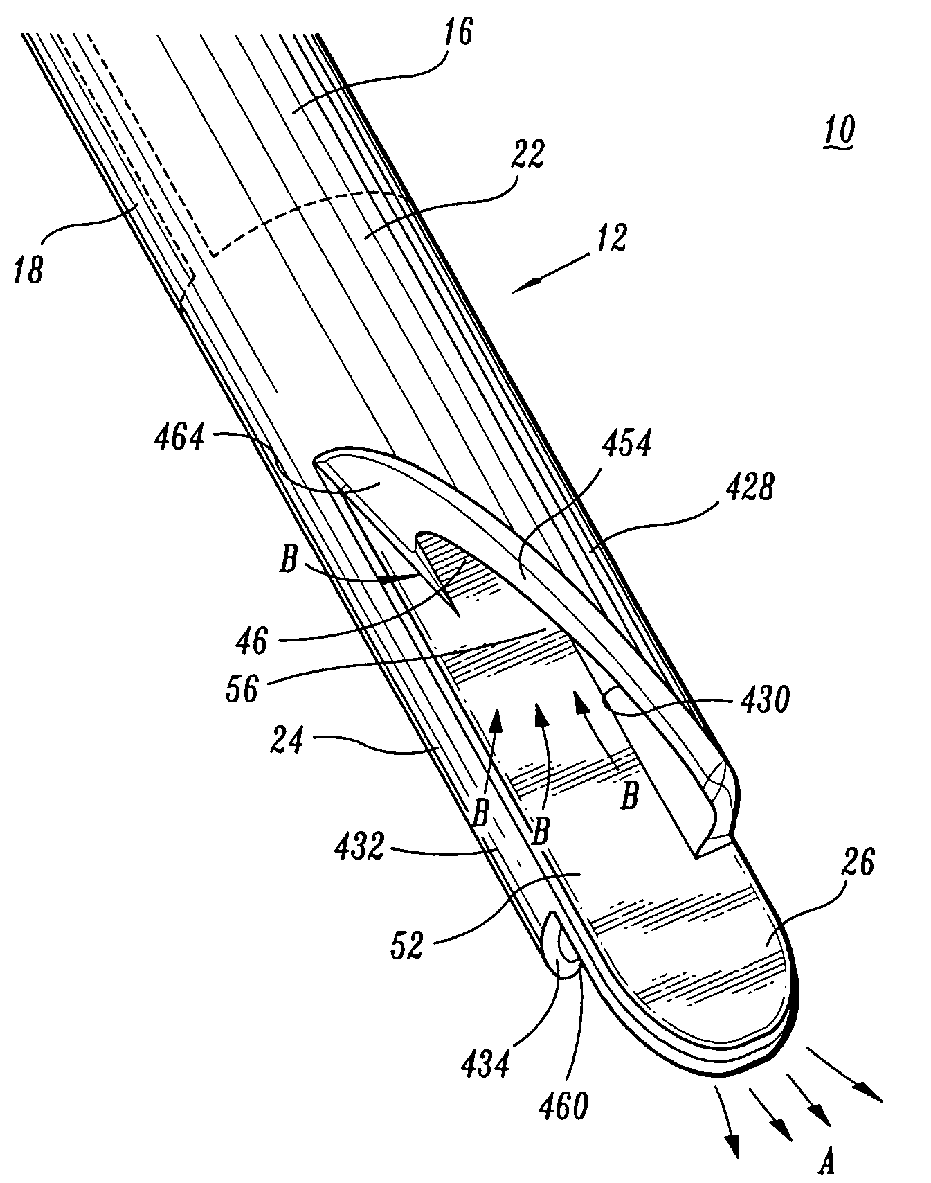 Catheter with occlusion resistant tip