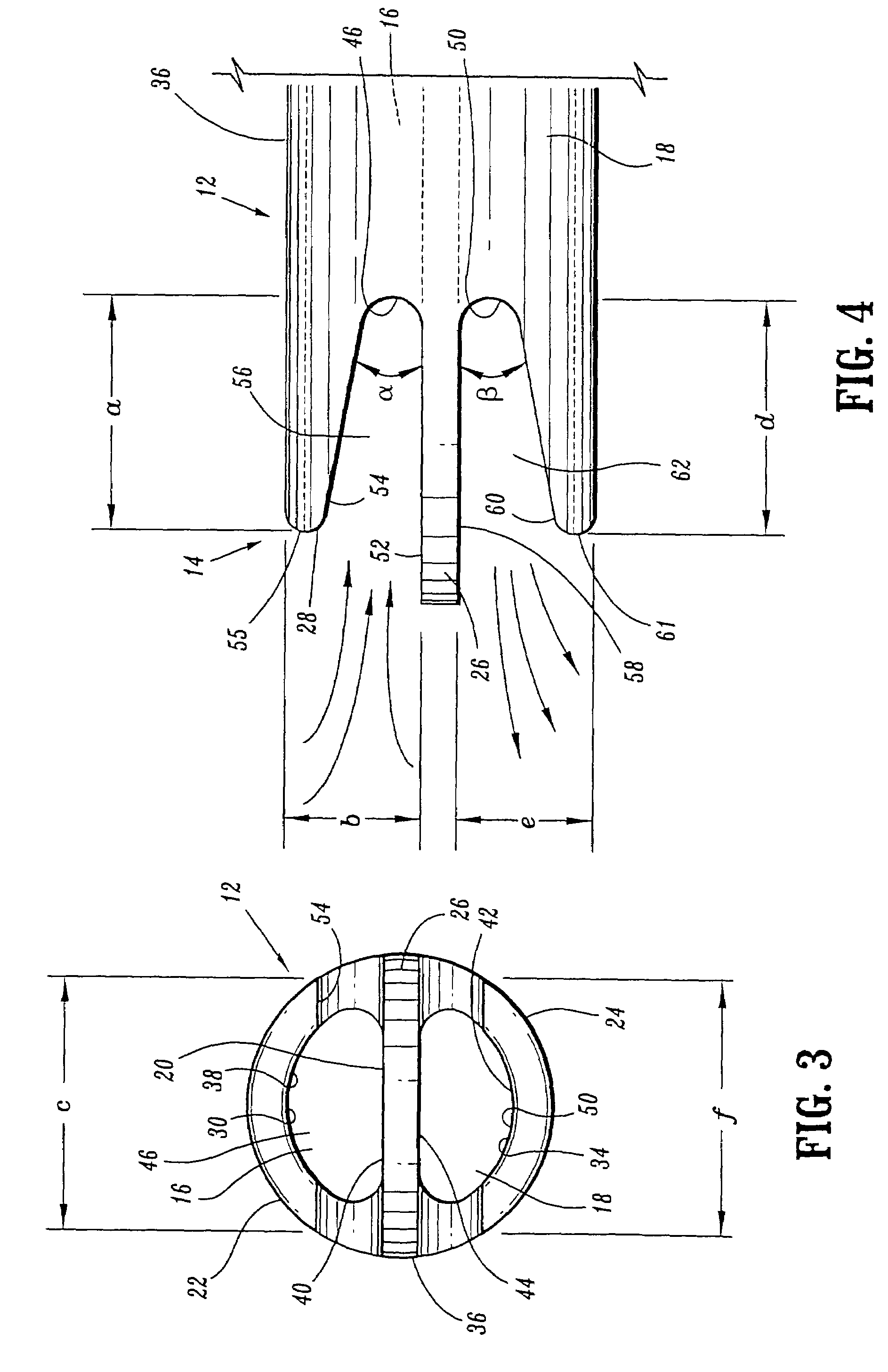 Catheter with occlusion resistant tip