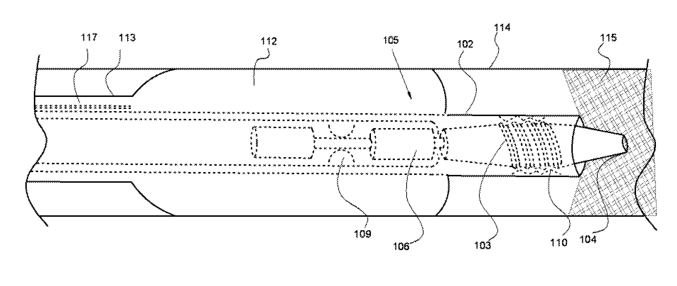 System and Method for the Treatment of Occluded Vessels