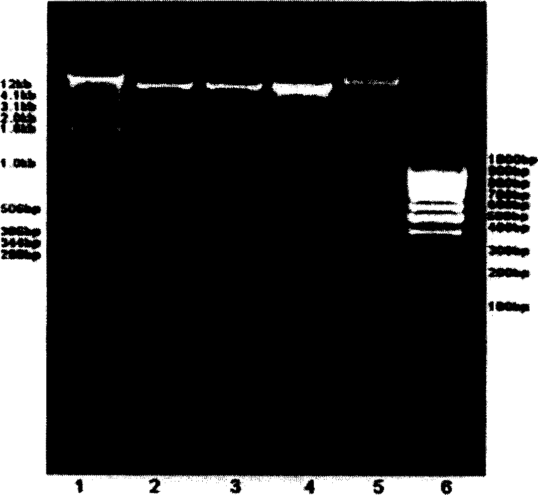 Recombinant human parathormone PTH1-34 preparation method