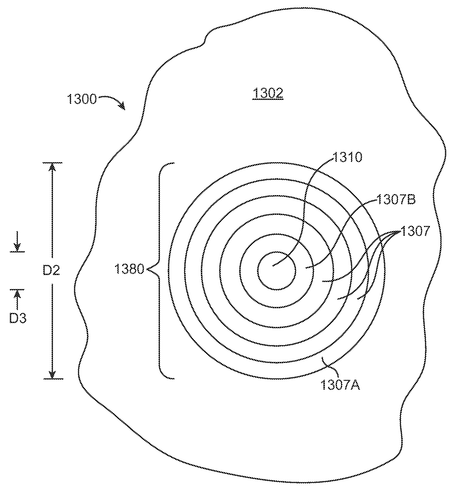 Stent graft having a flexible, articulable, and axially compressible branch graft