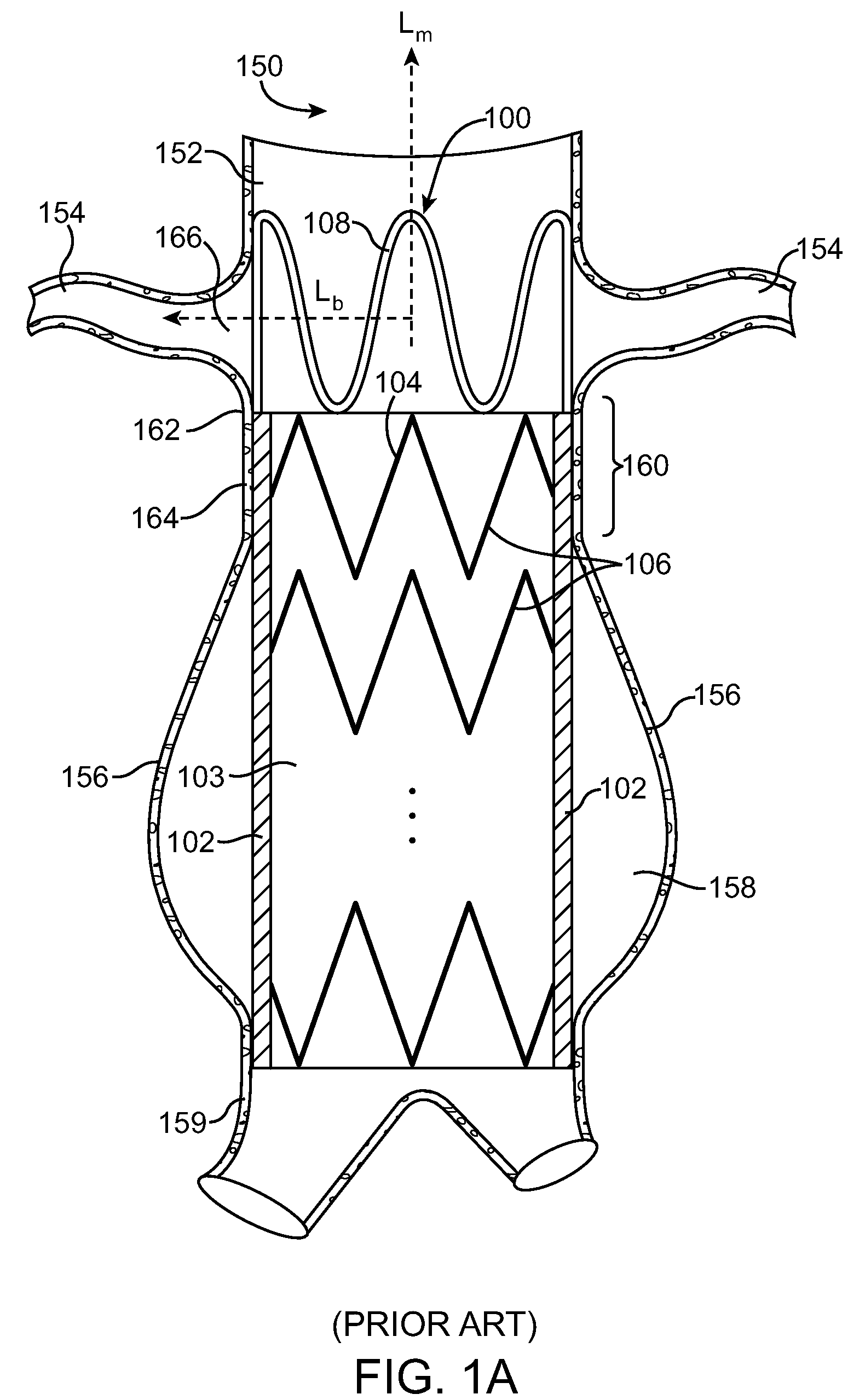 Stent graft having a flexible, articulable, and axially compressible branch graft