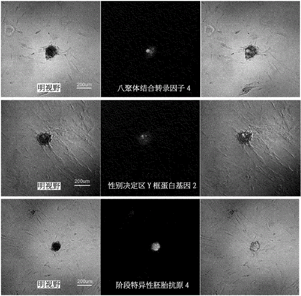 Method for differentiating pluripotent stem cell induced from mesenchymal stem cell into osteoblast