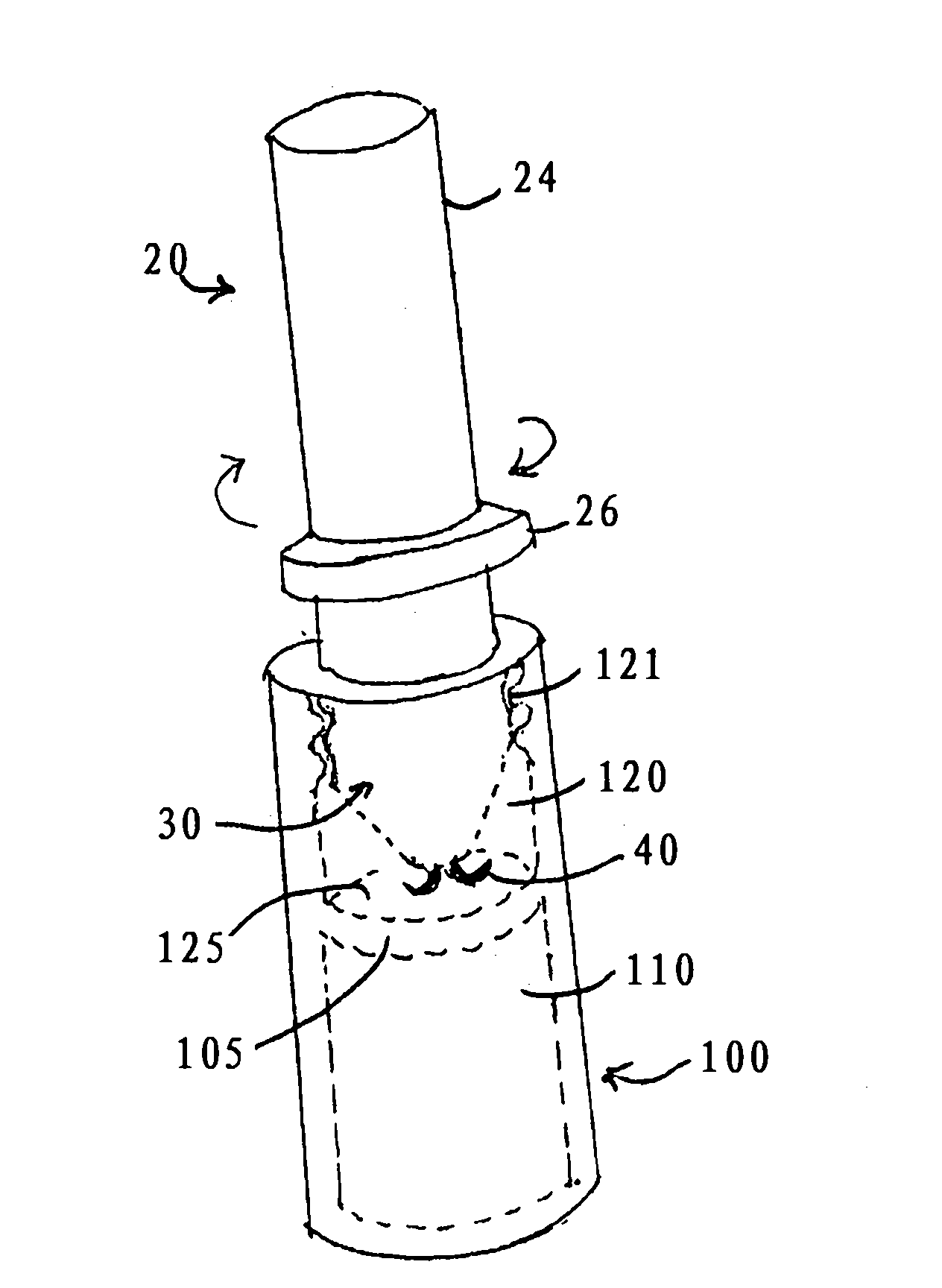 Lancet system