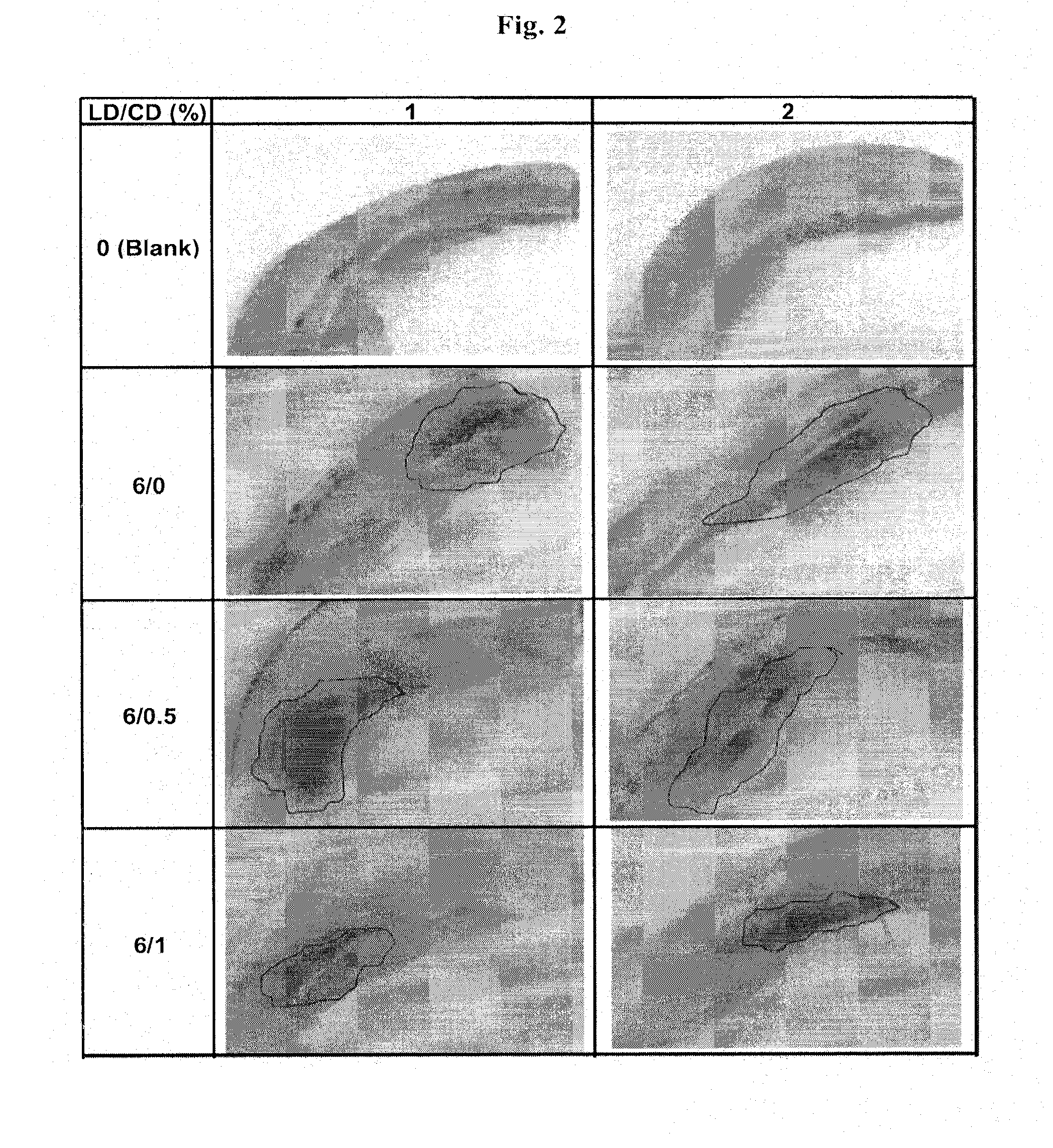 Continuous administration of l-dopa, dopa decarboxylase inhibitors, catechol-o-methyl transferase inhibitors and compositions for same