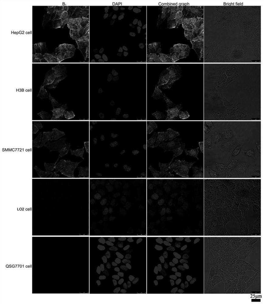 Fluorescent compound and its preparation method, and its application in cross-validation localization of liver tumor lesion tissue