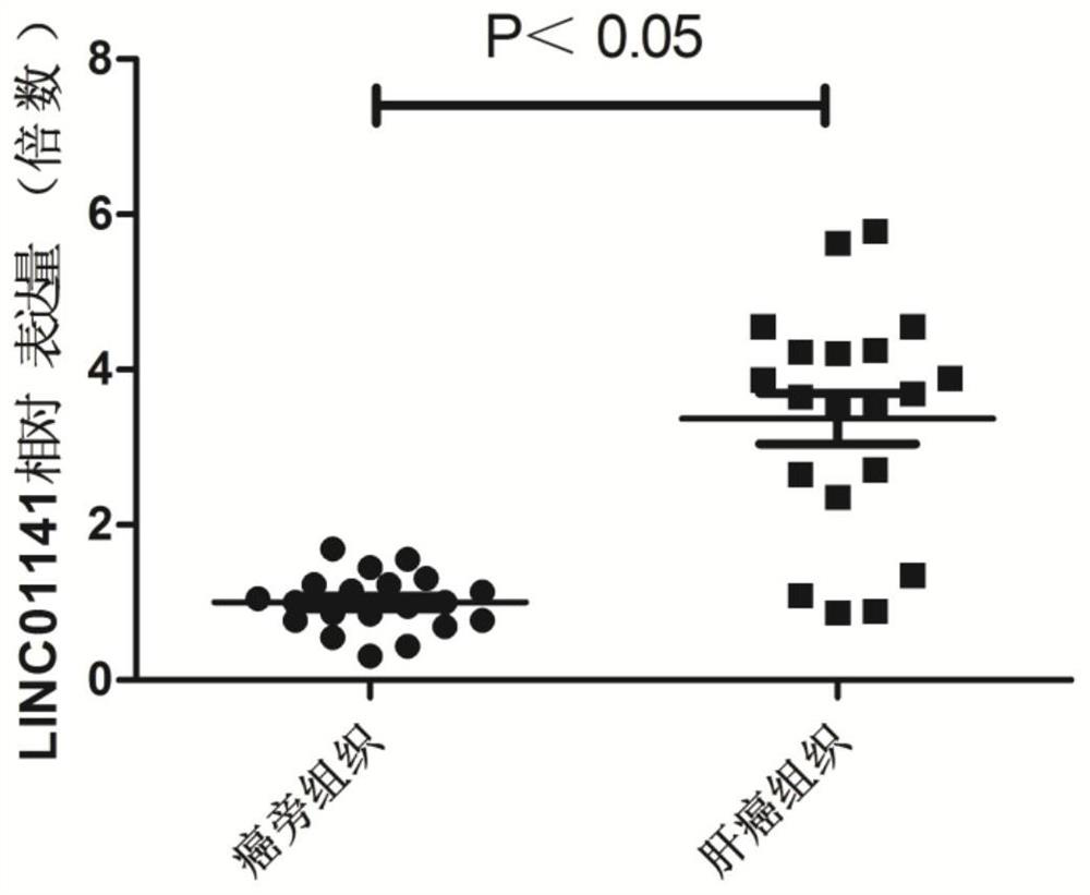 Application of long-chain non-coding RNA LINC01141 in preparation of pharmaceutical composition for treating liver cancer