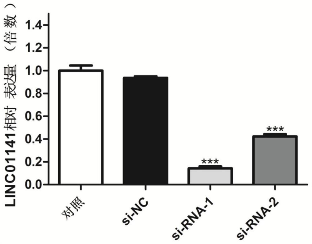 Application of long-chain non-coding RNA LINC01141 in preparation of pharmaceutical composition for treating liver cancer