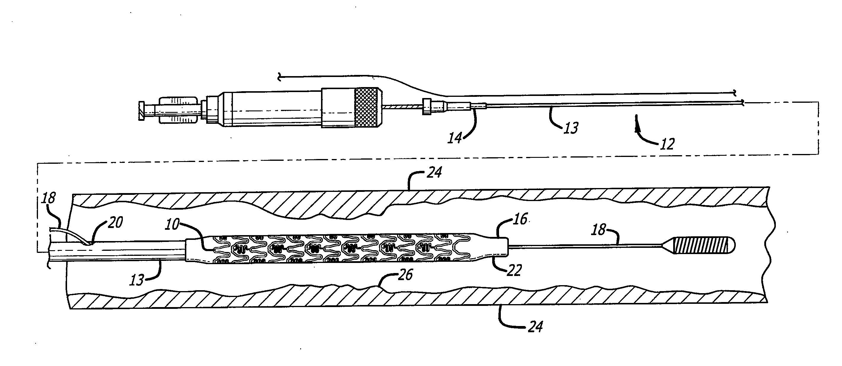 Apparatus and method for formation of foil-shaped stent struts