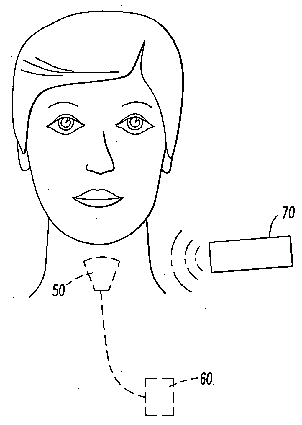 Method and device for the electrical treatment of sleep apnea and snoring