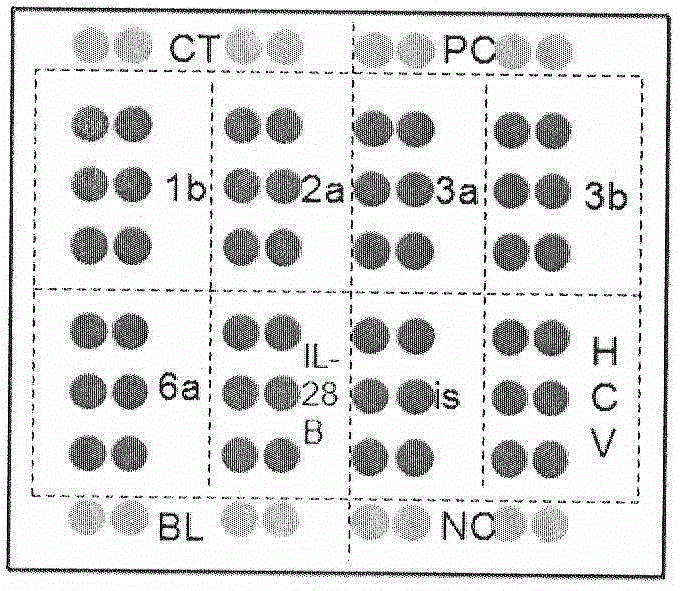 Preparation and application of guiding gene chip for HCV infection individual treatment