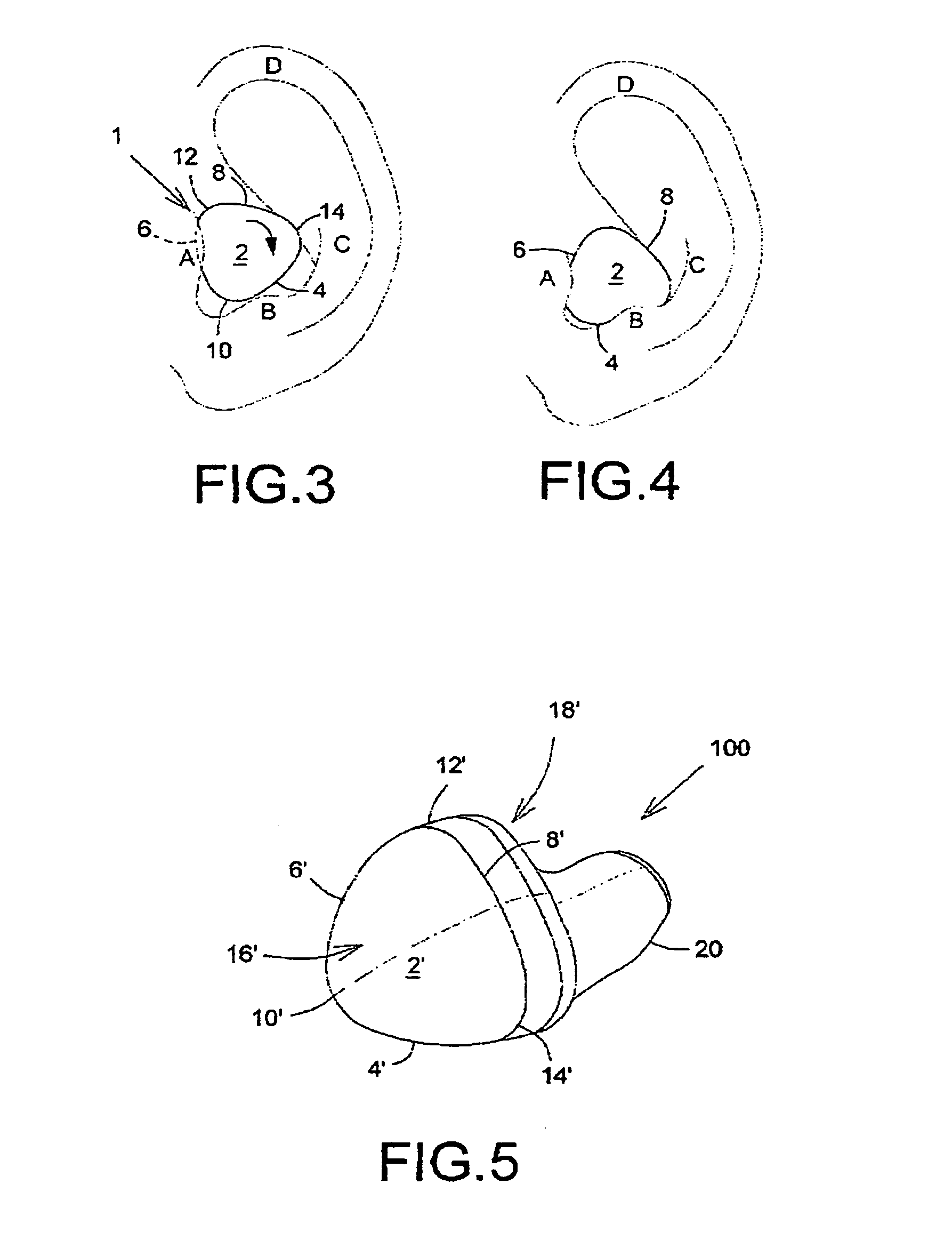 Quasi-triangular in-ear device