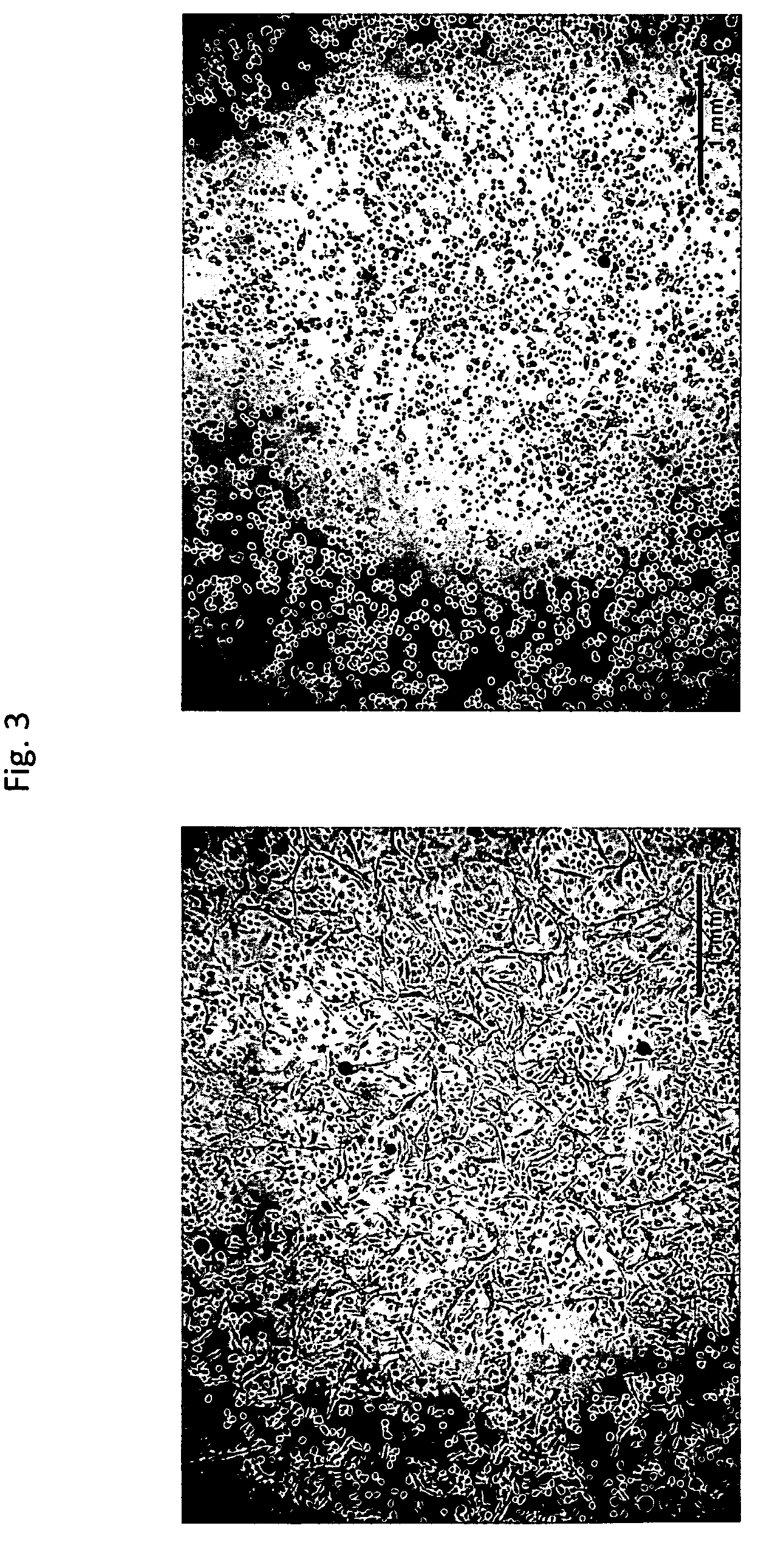 Method for removing endotoxin from proteins