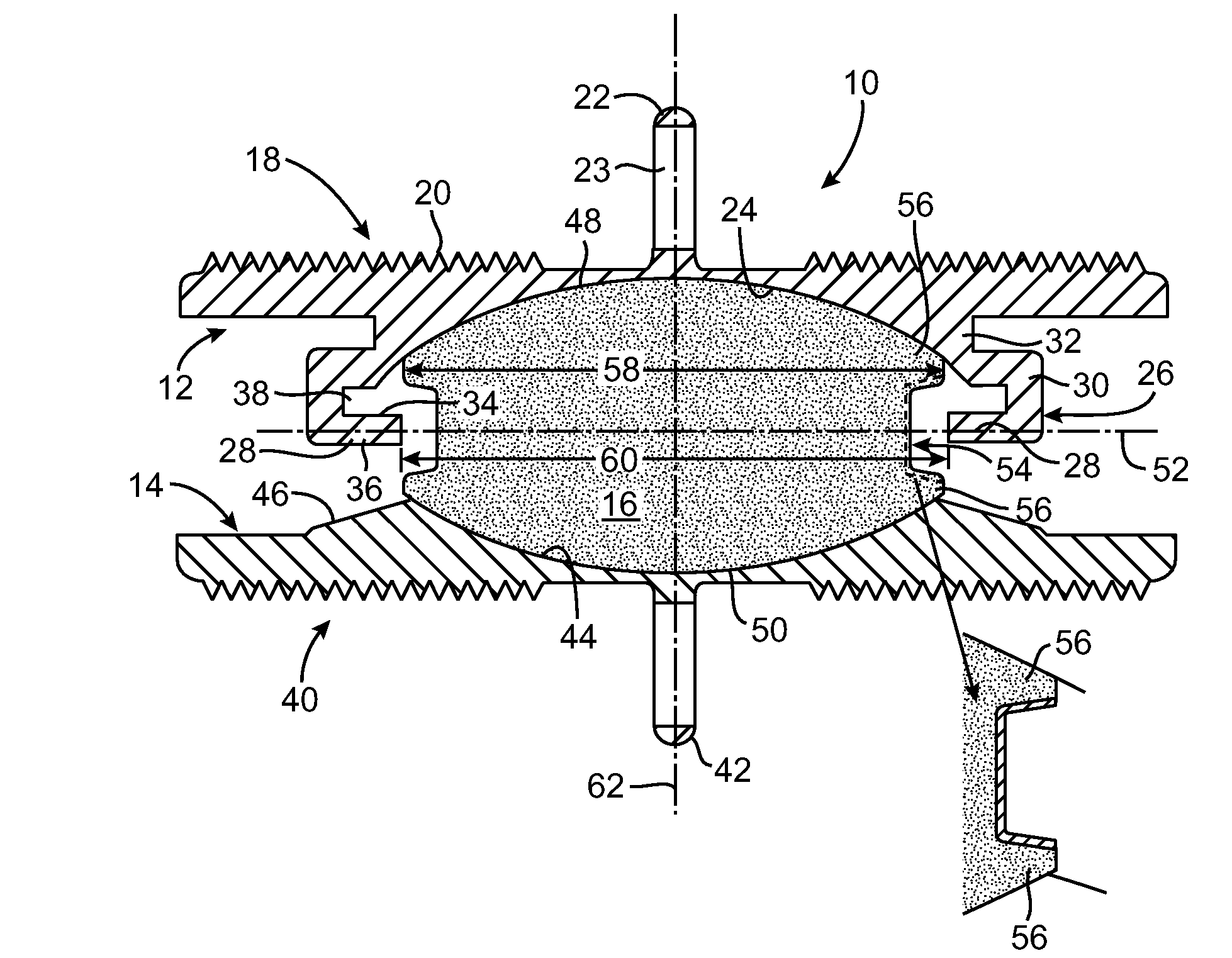 Customized Intervertebral Prosthetic Disc with Shock Absorption