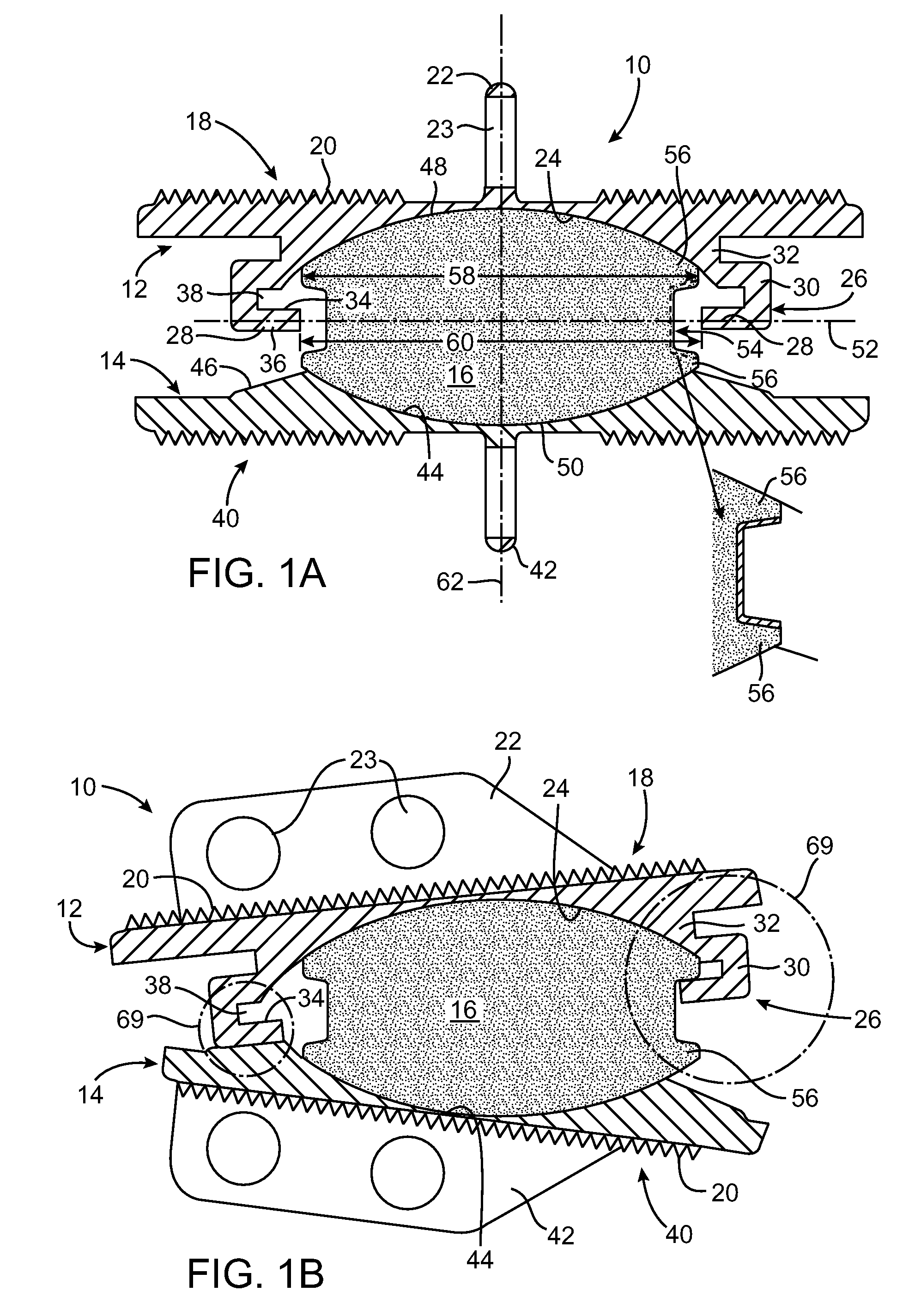 Customized Intervertebral Prosthetic Disc with Shock Absorption