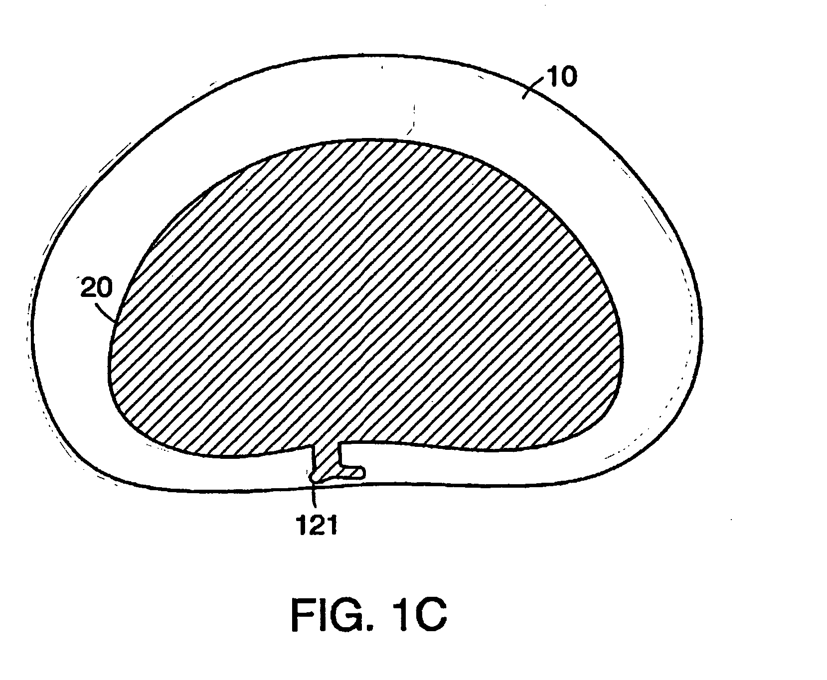 Intervertebral disc implant resistant to migration