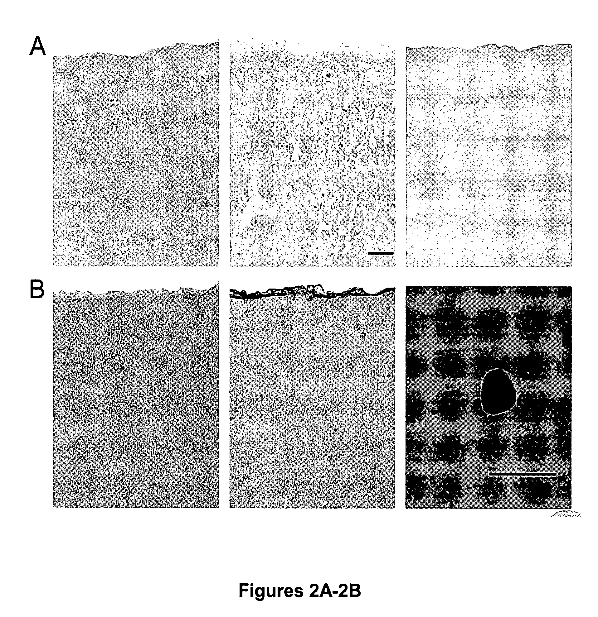 Treatment and screening methods for promoting neurogenesis