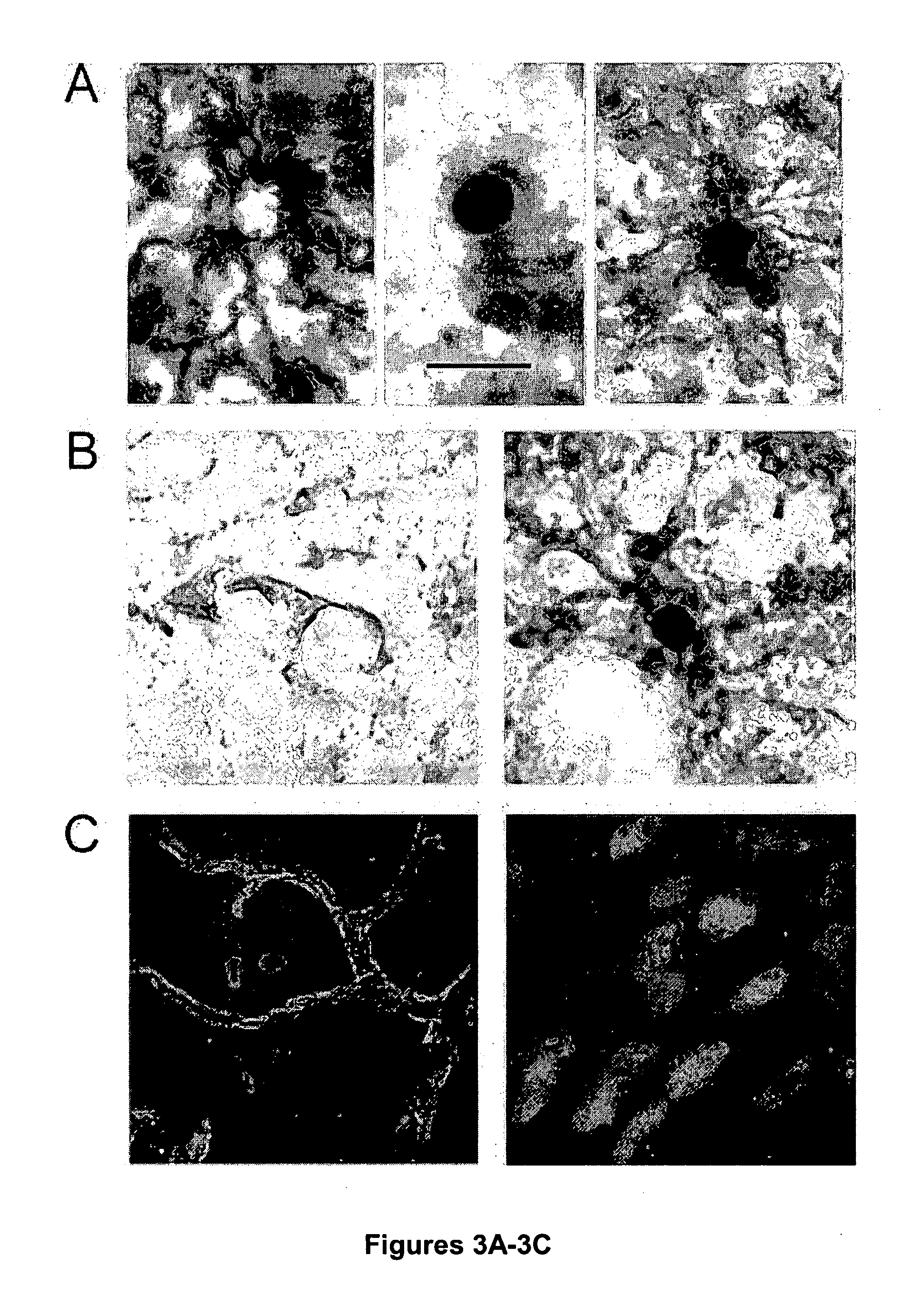 Treatment and screening methods for promoting neurogenesis