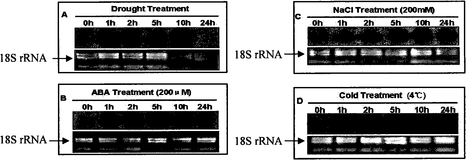 Plant stress tolerance correlative protein, coding gene and application thereof