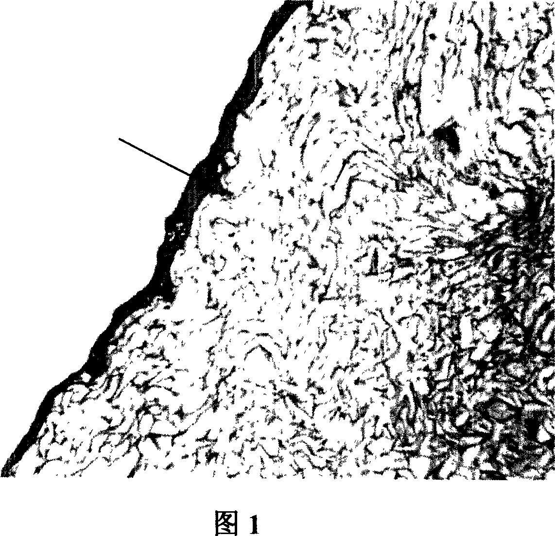 Collagen-chitosan / fibrin glue asymmetric bracket and the preparing method and the application thereof