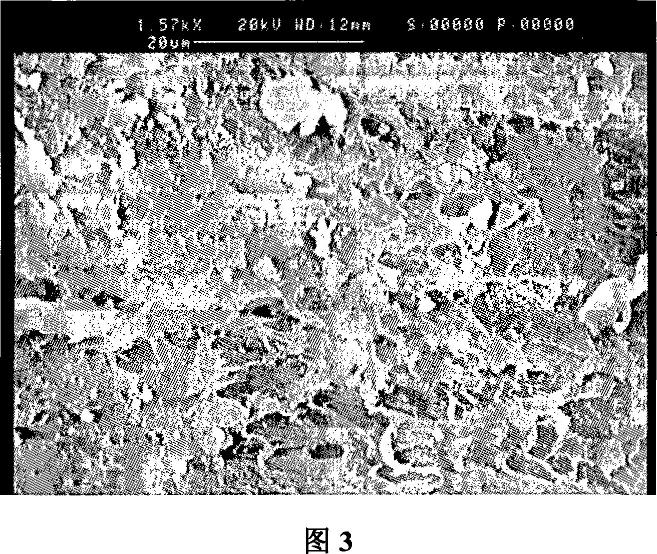 Collagen-chitosan / fibrin glue asymmetric bracket and the preparing method and the application thereof