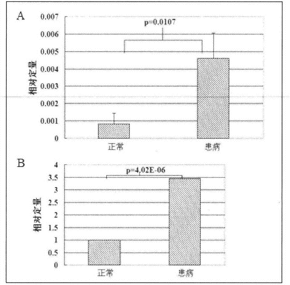 Breed selection method for improving mastitis resistance of dairy cow and use thereof