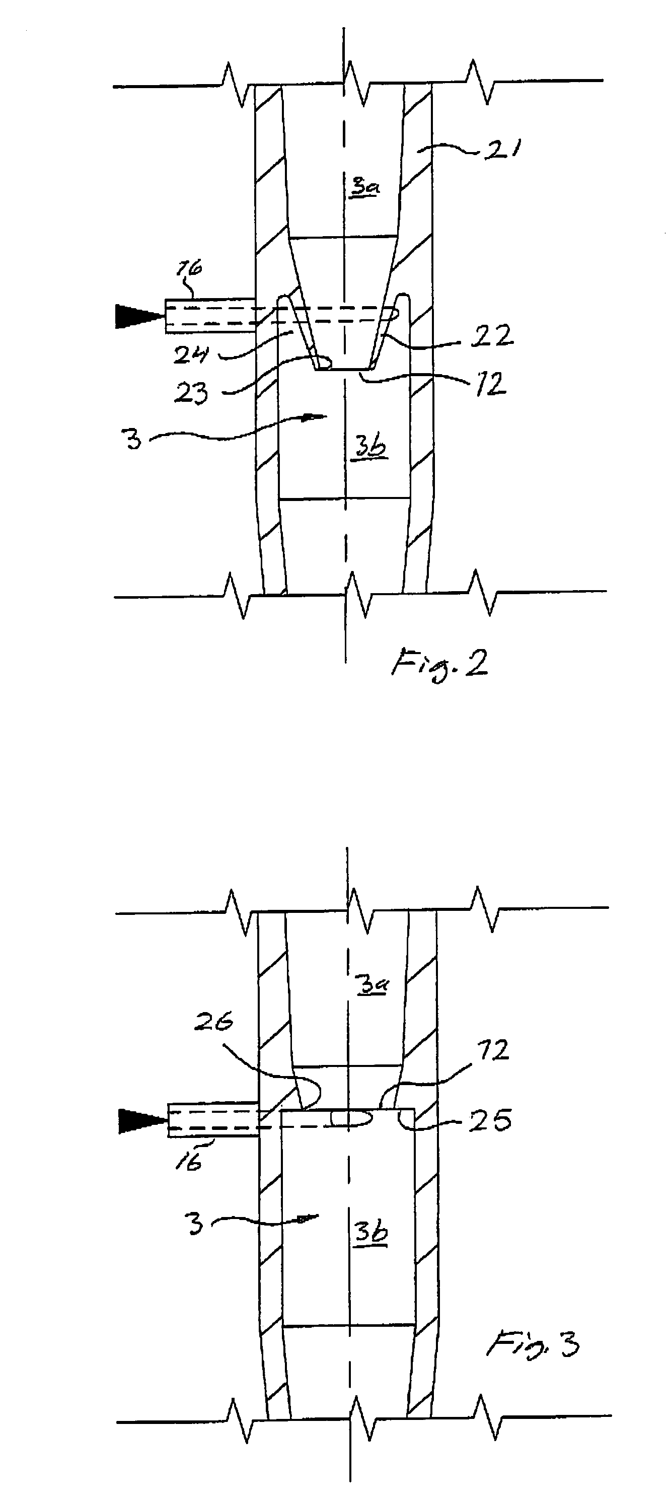 Separation of fibre pulp suspensions containing relatively heavy contaminants