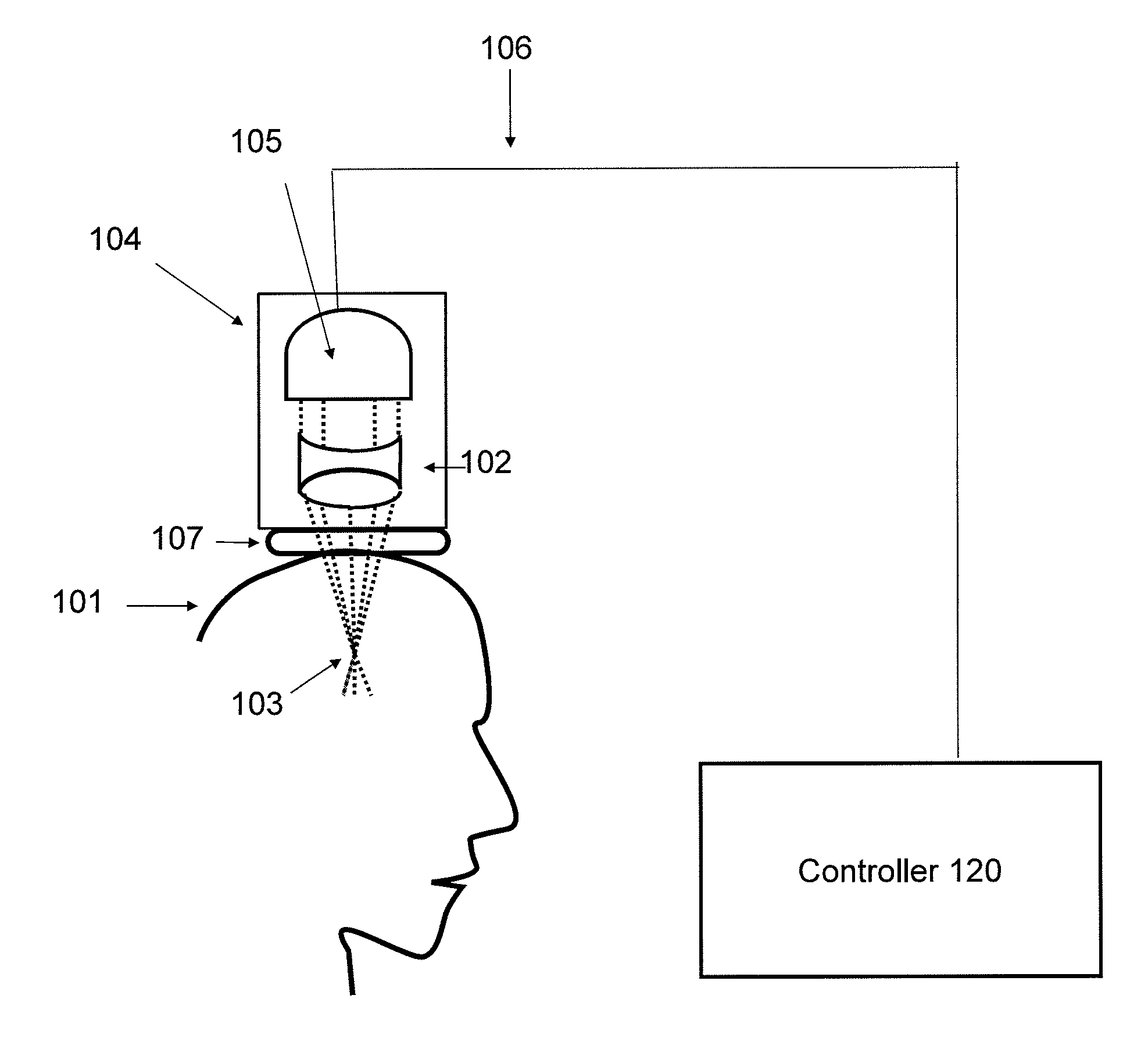 Focused transcranial ultrasound systems and methods for using them