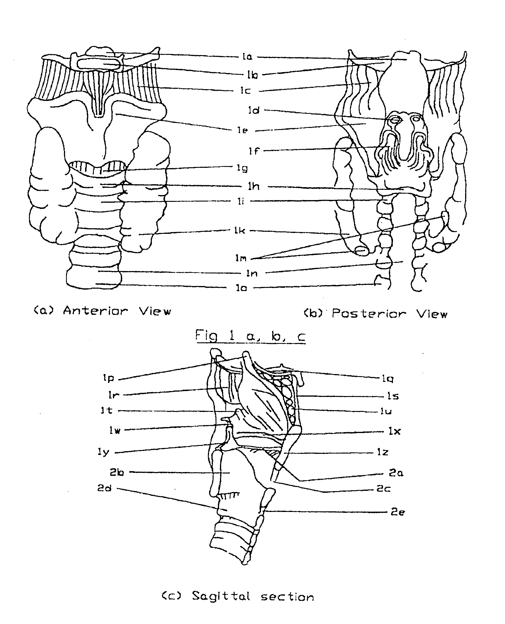 Airway device