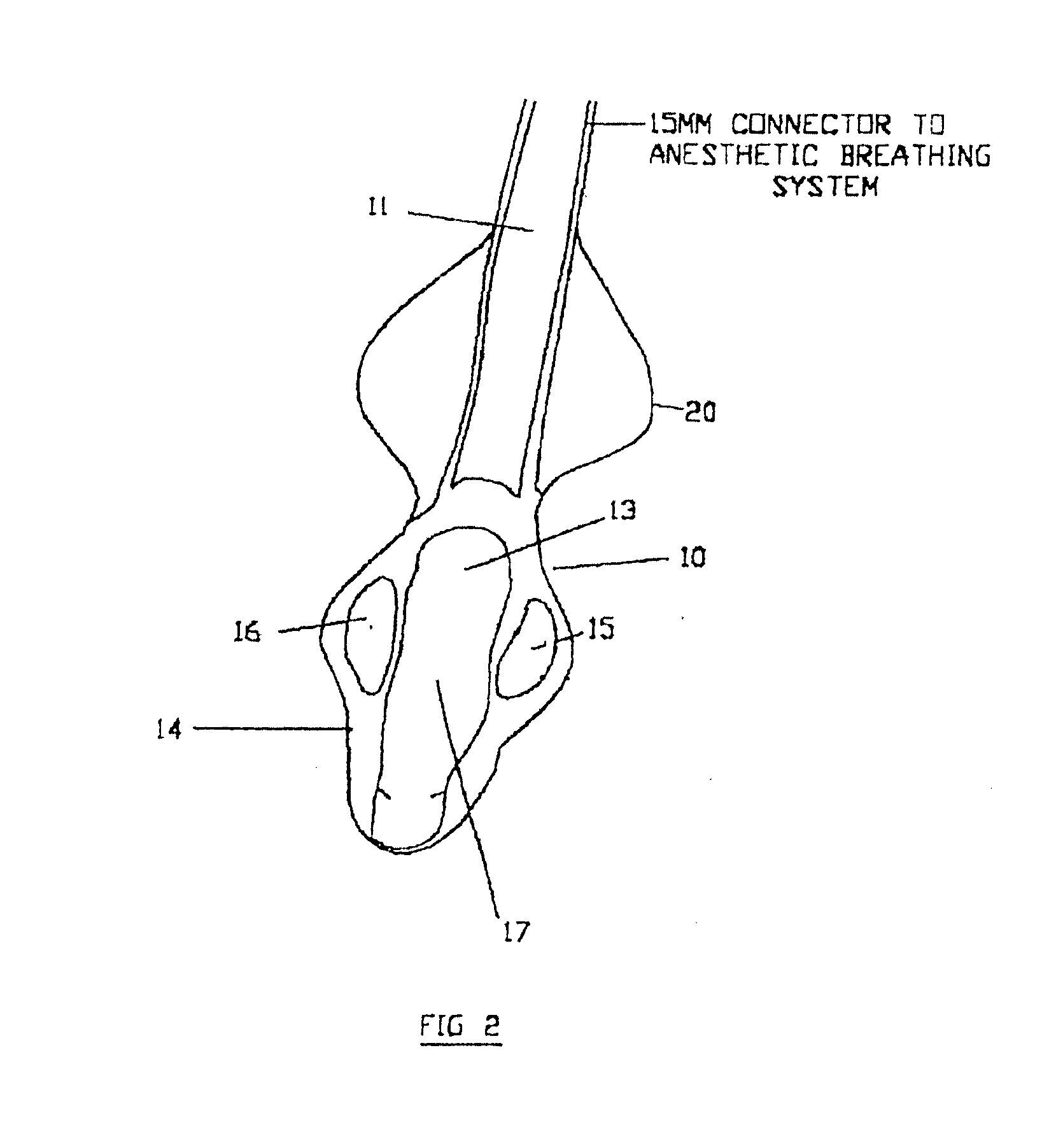 Airway device