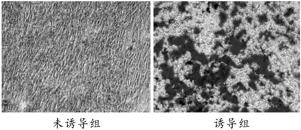 Amniotic mesenchymal stem cell resuscitation culture medium and resuscitation culture method thereof