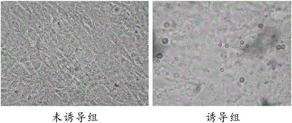 Amniotic mesenchymal stem cell resuscitation culture medium and resuscitation culture method thereof