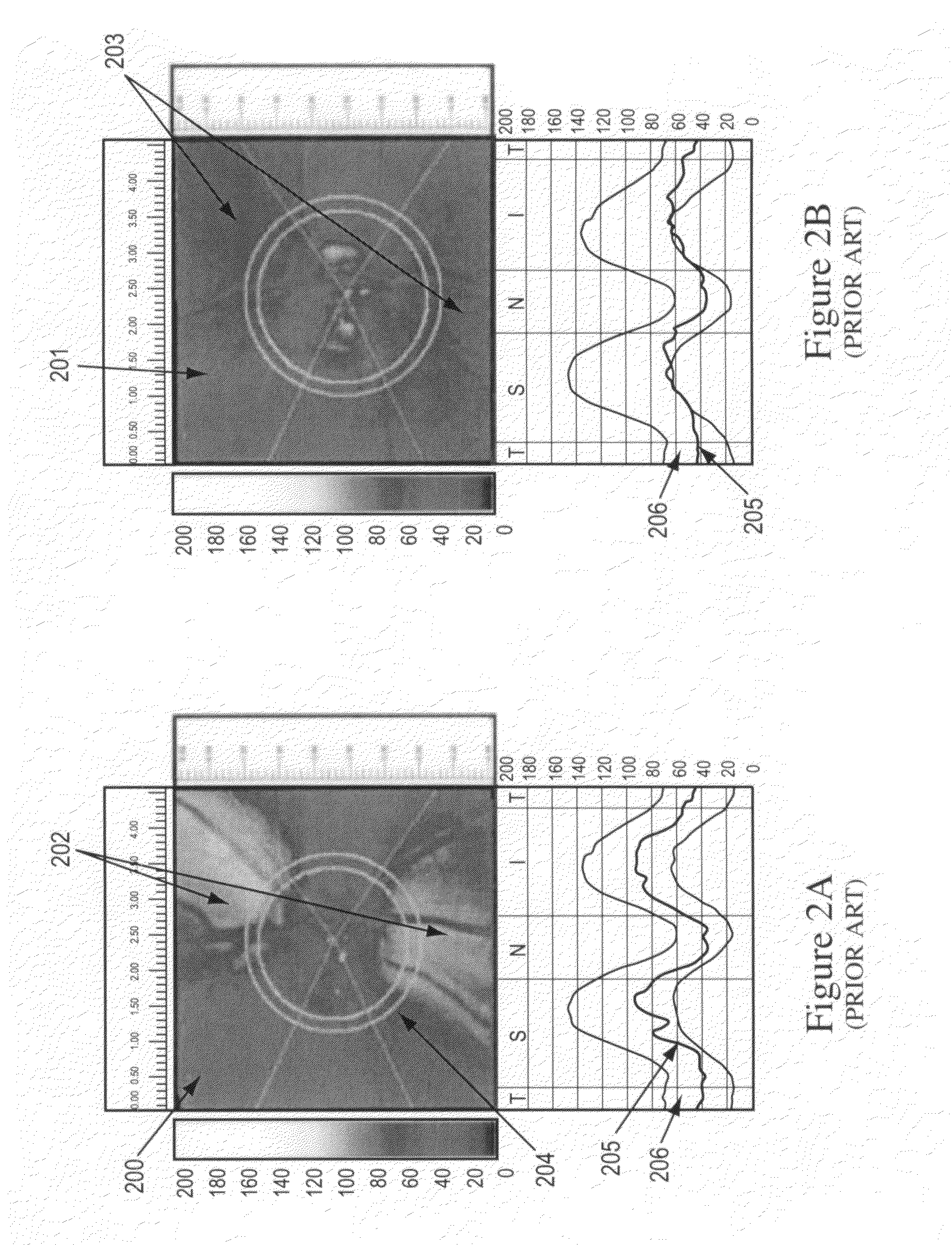 Method of eye examination by optical coherence tomography