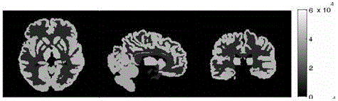 Maximum a posteriori reconstruction method for pet images based on joint prior model of anatomical function