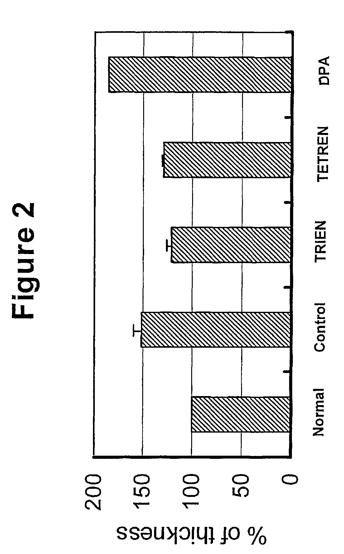 Copper chelators for treating ocular inflammation