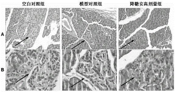 Chinese medicine for treating diabetes