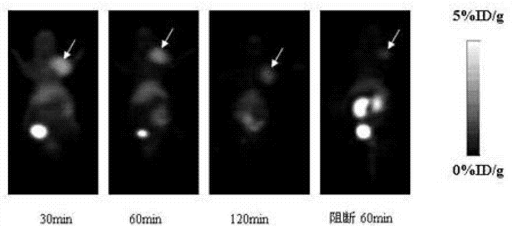 PET (Positron Emission Tomography) tracer with FSHR (Follicle-stimulating Hormone Receptor) targeting as well as preparation method and application thereof