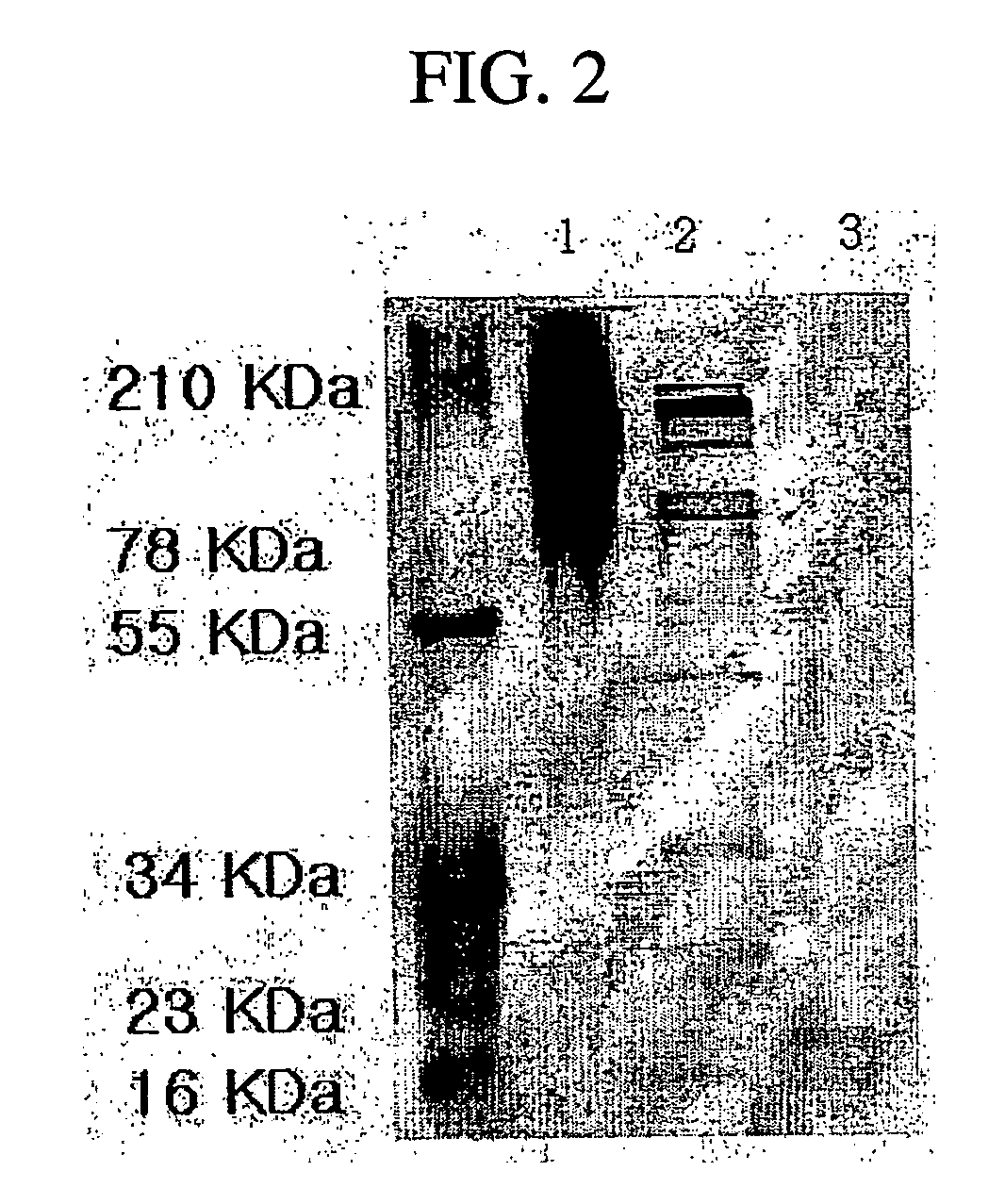 Composition for preventing the formation of new scar comprising bmp-7