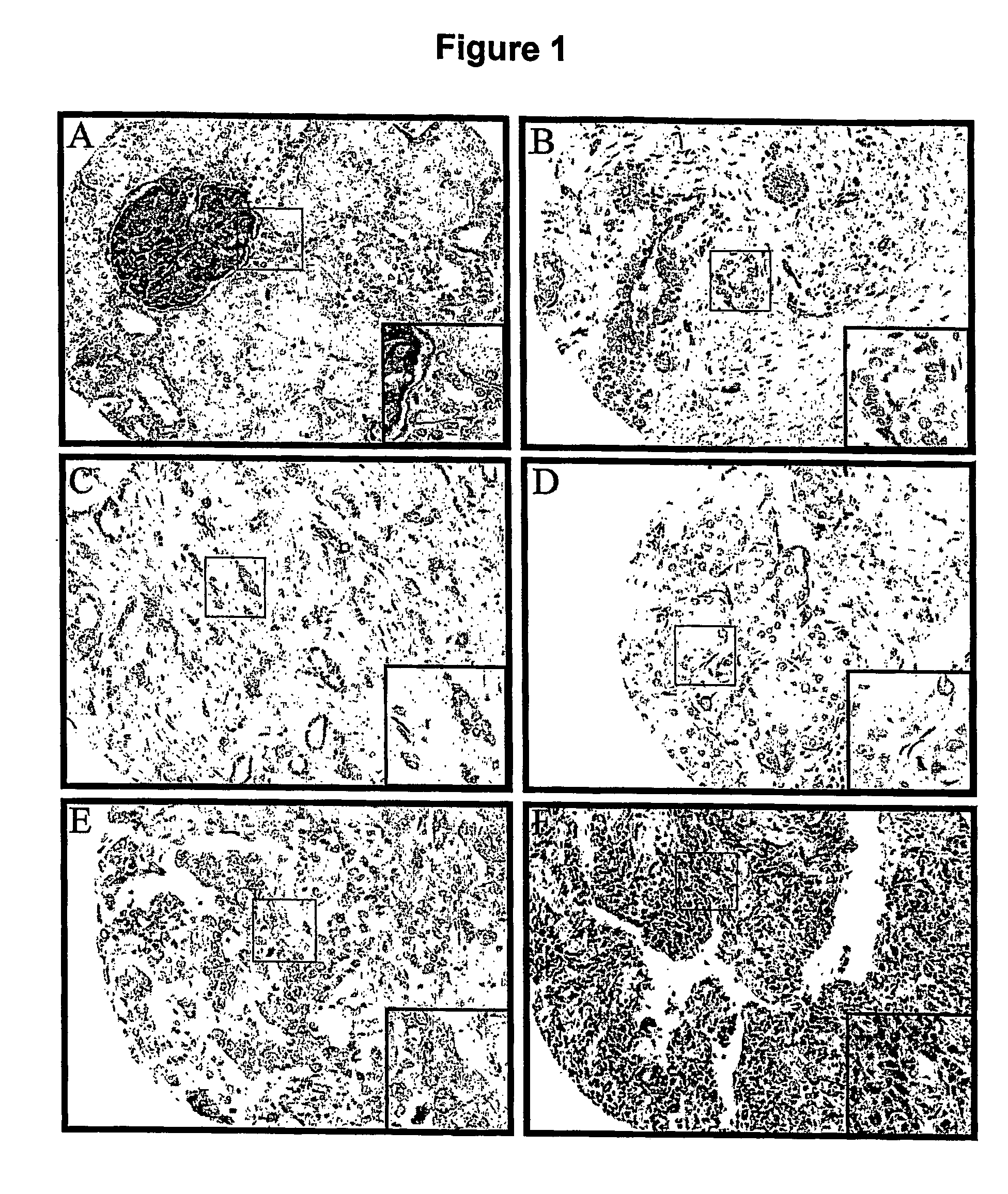 Methods for detecting and treating cancer