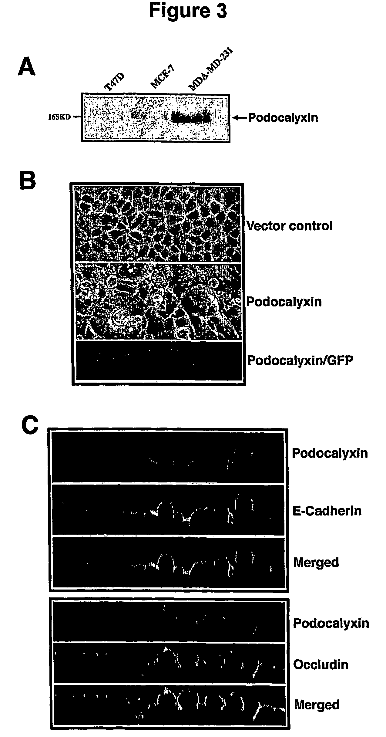 Methods for detecting and treating cancer