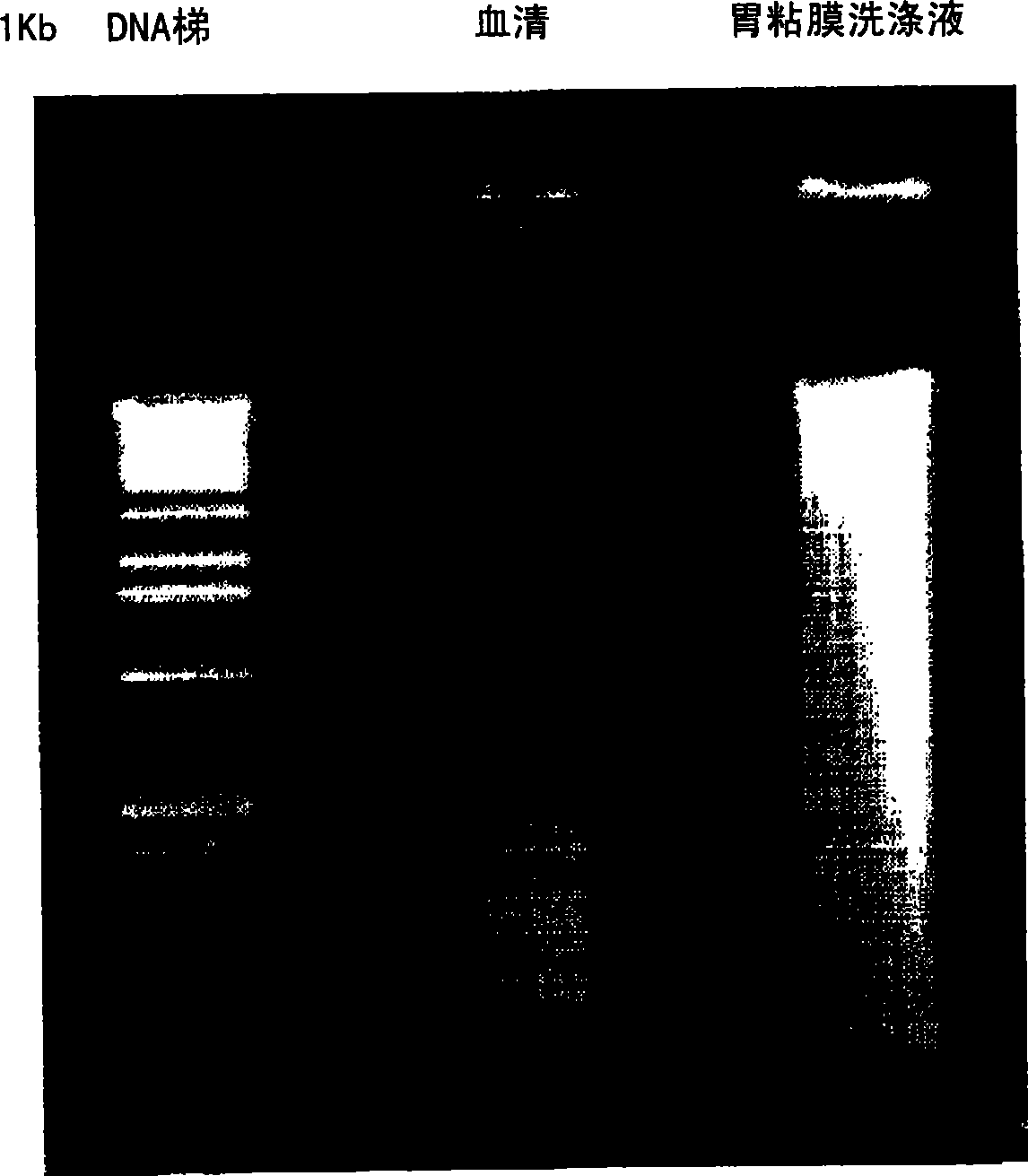 Method for detecting disease-related marker using gastric mucosal lavage fluid