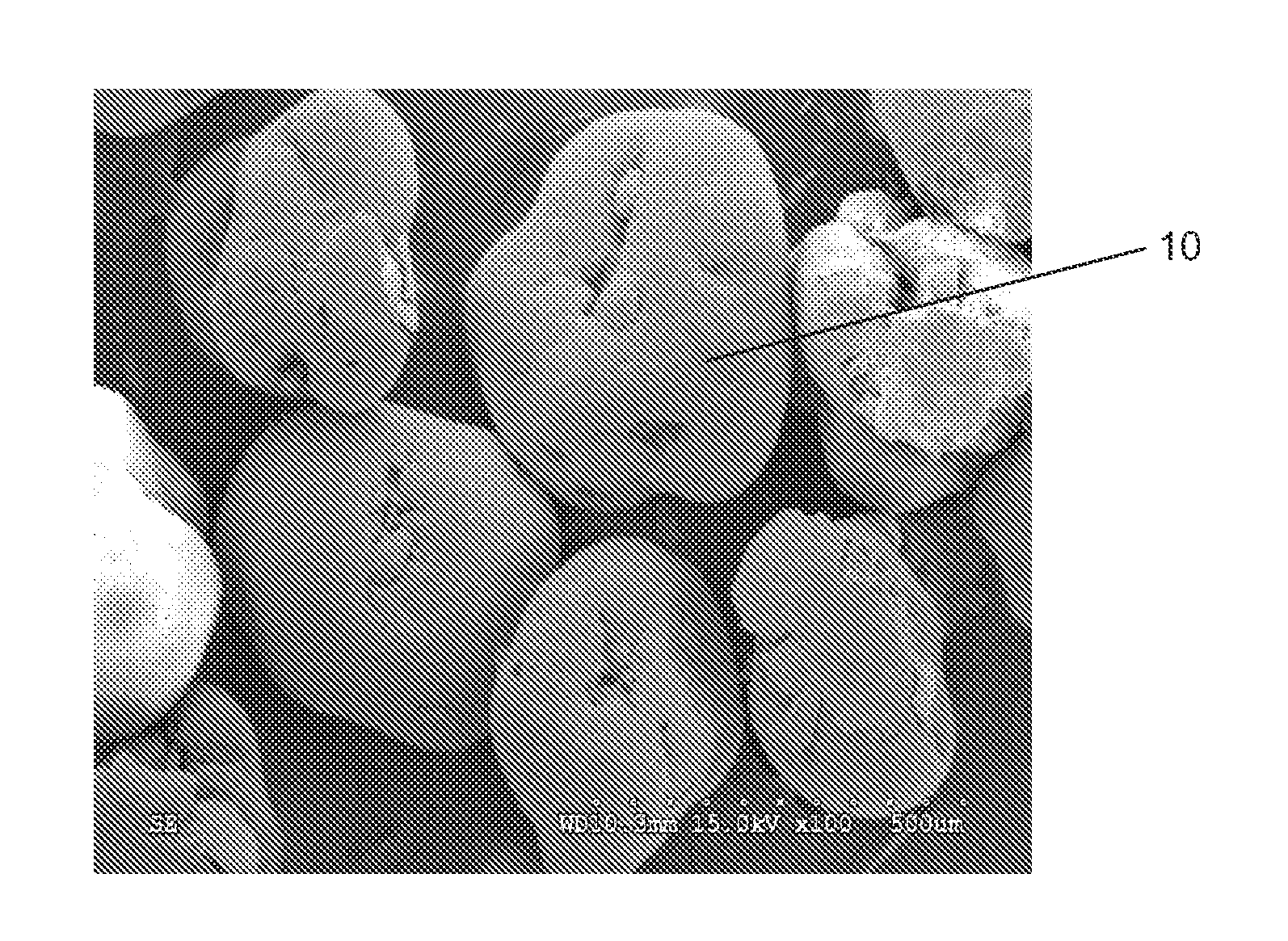 Calcium sulfate composite particles including aggregated calcium sulfate nanoparticles and method of use for bone augmentation